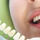 ホワイトニング